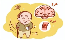脑血栓的预防