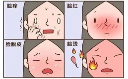 “桑拿天”警惕夏季皮肤病！医生：做好防晒、小心虫咬皮炎