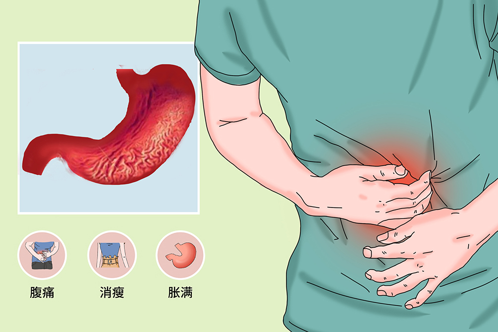 医生提醒：得了这4种胃病的人，最容易被胃癌盯上，别大意！