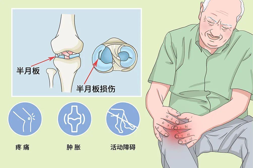 半月板损伤能不能彻底治好