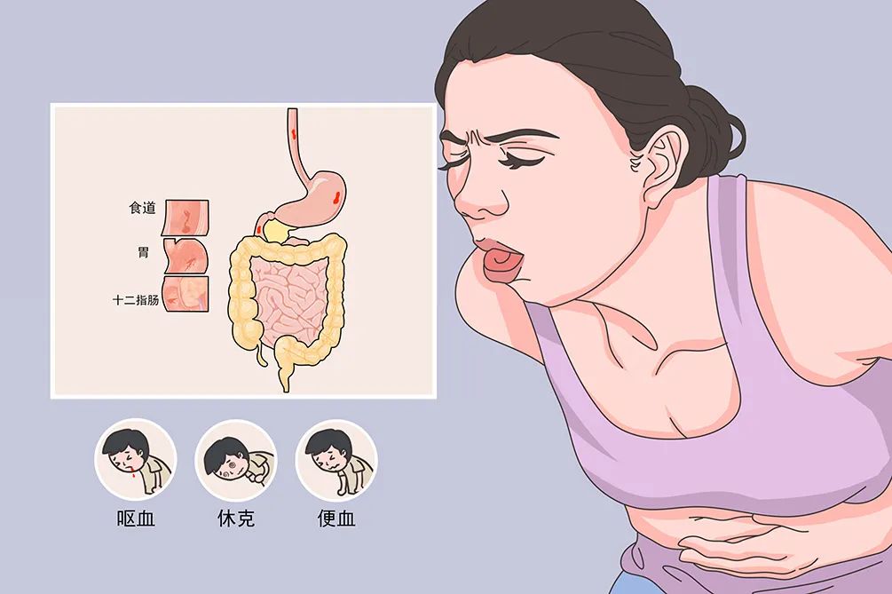 预防胃溃疡需要怎么做？5种方法帮助预防胃溃疡？